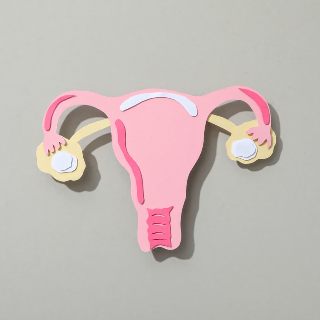 Миома матки: что это, почему возникает и как лечить