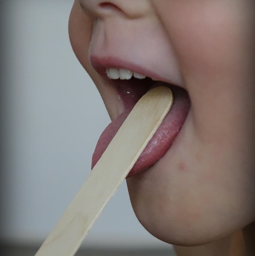 Скарлатина: признаки инфекции, осложнения и профилактика