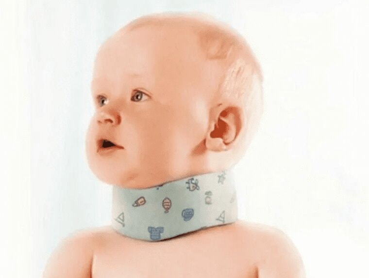 Trelax Бандаж шейный для детей до года