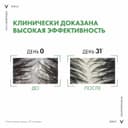 Vichy Dercos Шампунь от перхоти для сухих волос Сменный блок 500 мл