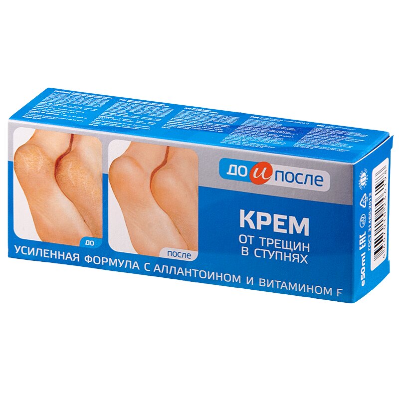 Изображение товара Крем для ног от трещин в ступнях 50 мл Твинс Тэк для ухода и заживления кожи ног
