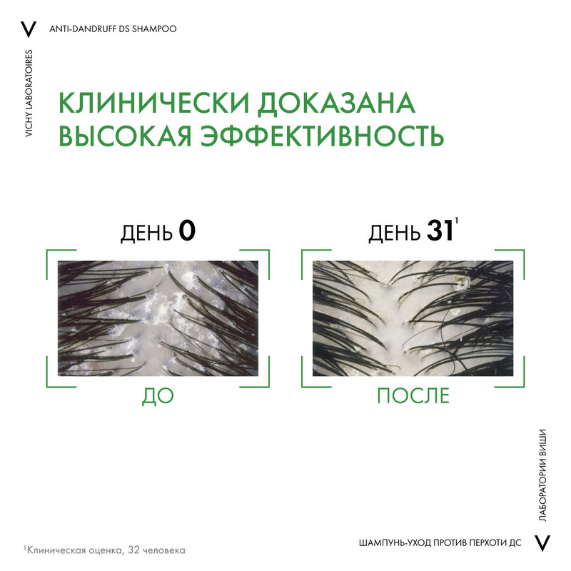 Vichy Dercos Шампунь-уход интенсивный против перхоти для нормальных и жирных волос 390 мл